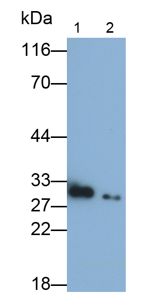 Polyclonal Antibody to Carbonic Anhydrase II (CA2)