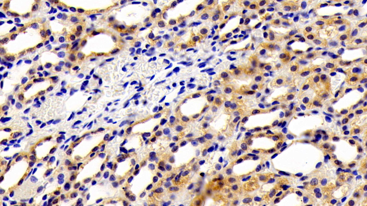 Polyclonal Antibody to Kidney Injury Molecule 1 (Kim1)