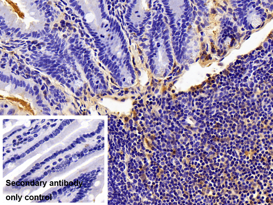 Polyclonal Antibody to Ficolin 1 (FCN1)