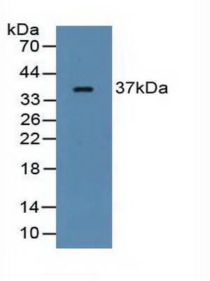 Polyclonal Antibody to Ficolin 1 (FCN1)