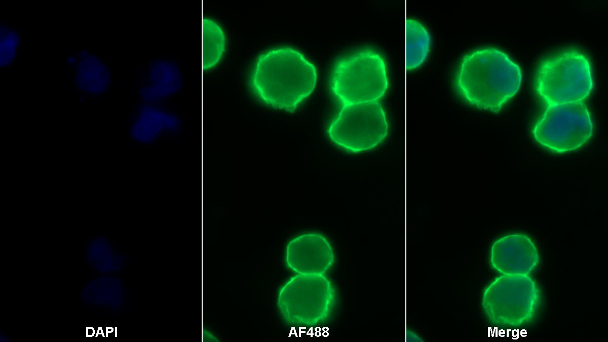 Polyclonal Antibody to Programmed Cell Death Protein 1 Ligand 1 (PDL1)