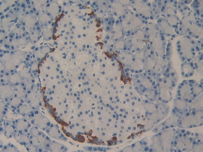 Polyclonal Antibody to Programmed Cell Death Protein 1 Ligand 2 (PDL2)