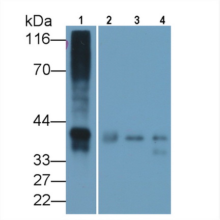 Polyclonal Antibody to Osteonectin (ON)