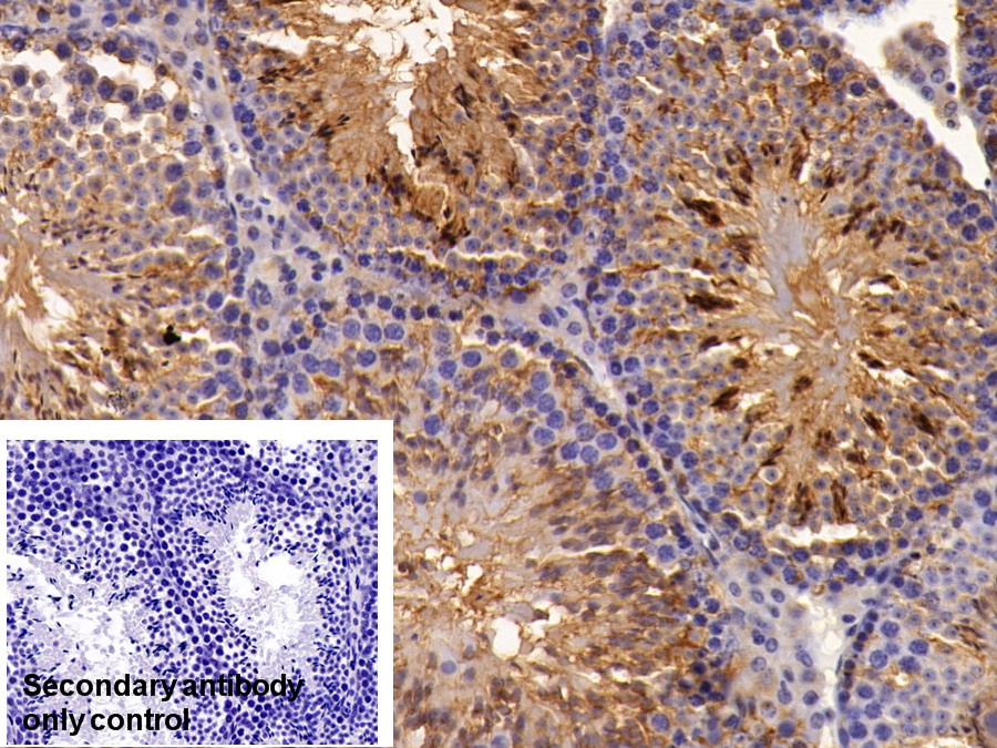 Polyclonal Antibody to Osteonectin (ON)