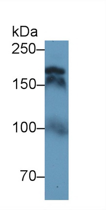 Polyclonal Antibody to Topoisomerase II (TOP2)