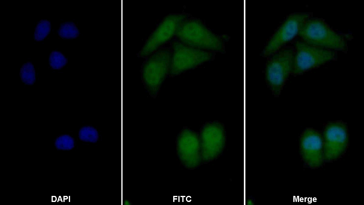 Polyclonal Antibody to Cyclin Dependent Kinase Inhibitor 2A (CDKN2A)