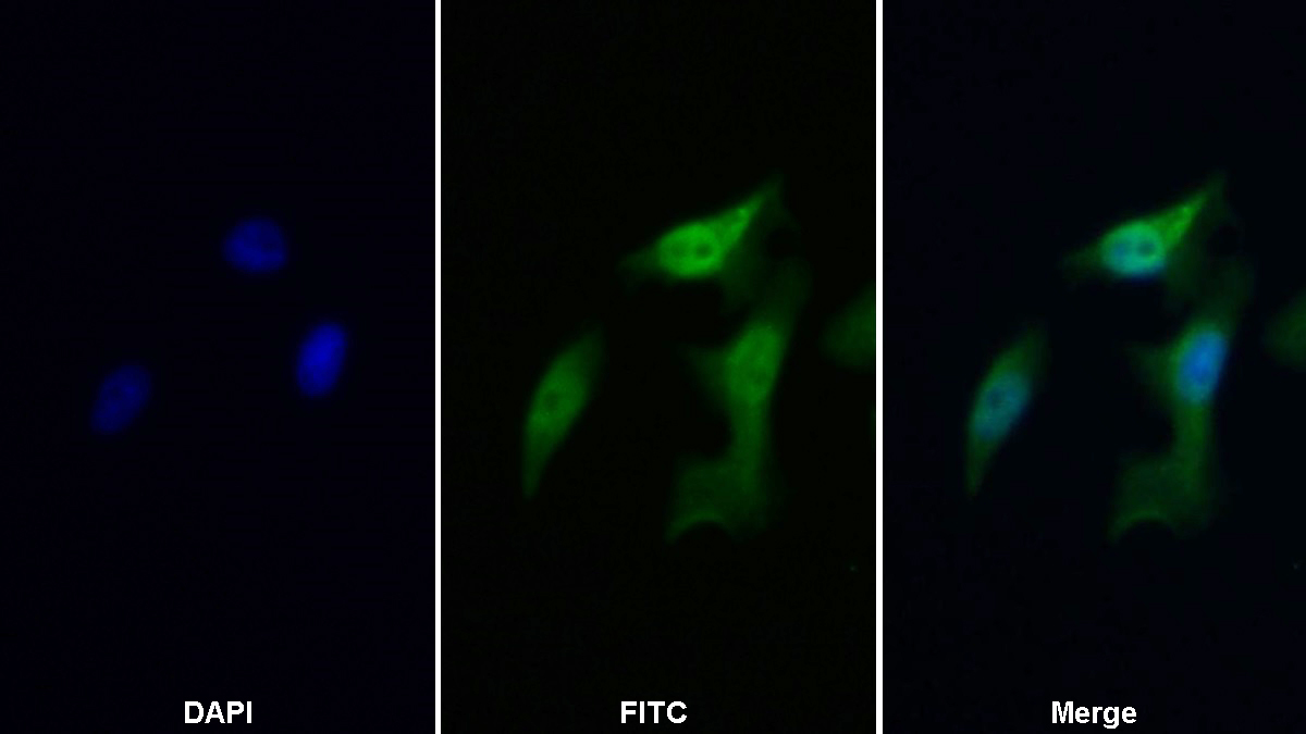 Polyclonal Antibody to Cyclin Dependent Kinase Inhibitor 2A (CDKN2A)