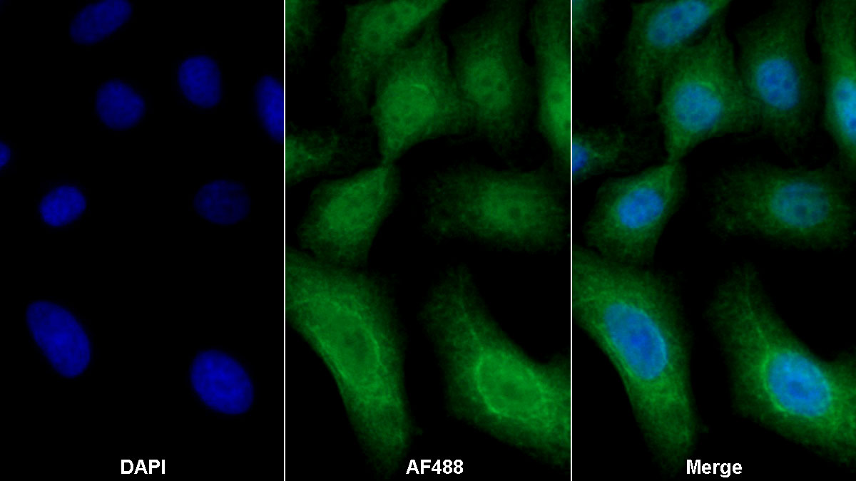 Polyclonal Antibody to Cyclin Dependent Kinase Inhibitor 2A (CDKN2A)