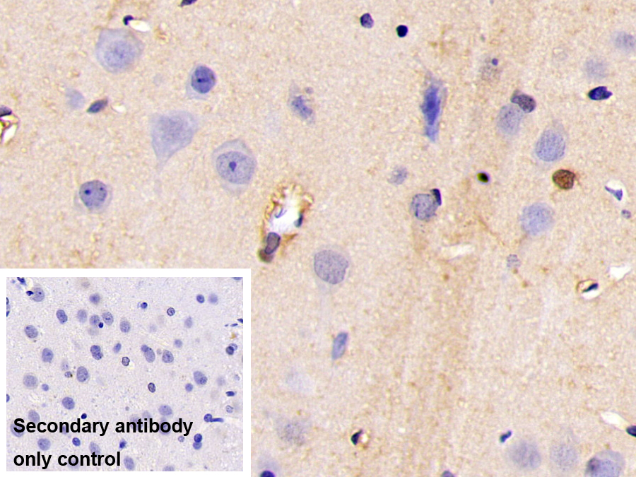 Polyclonal Antibody to Cyclin Dependent Kinase Inhibitor 2A (CDKN2A)