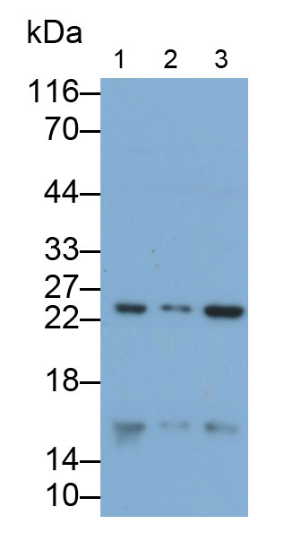 Polyclonal Antibody to Cyclin Dependent Kinase Inhibitor 2A (CDKN2A)