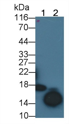 Polyclonal Antibody to Cyclin Dependent Kinase Inhibitor 2A (CDKN2A)