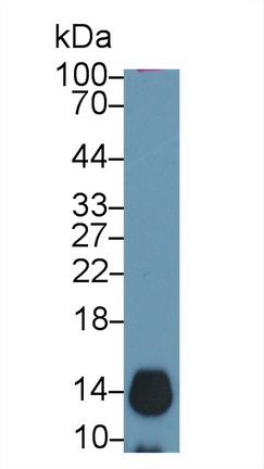 Polyclonal Antibody to Cyclin Dependent Kinase Inhibitor 2A (CDKN2A)