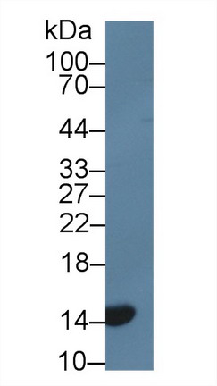 Polyclonal Antibody to Cyclin Dependent Kinase Inhibitor 2A (CDKN2A)