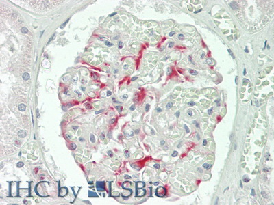 Polyclonal Antibody to Chemokine (C motif) ligand (XCL1)