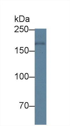 Polyclonal Antibody to Pregnancy Associated Plasma Protein A (PAPPA)