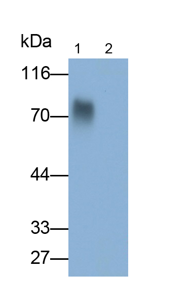 Polyclonal Antibody to Beta-Endorphin (bEP)