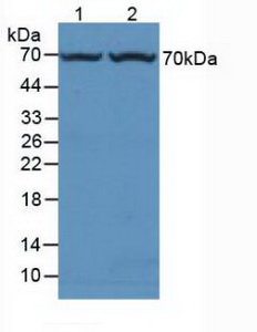 Polyclonal Antibody to Fucosidase Alpha L1, Tissue (FUCa1)