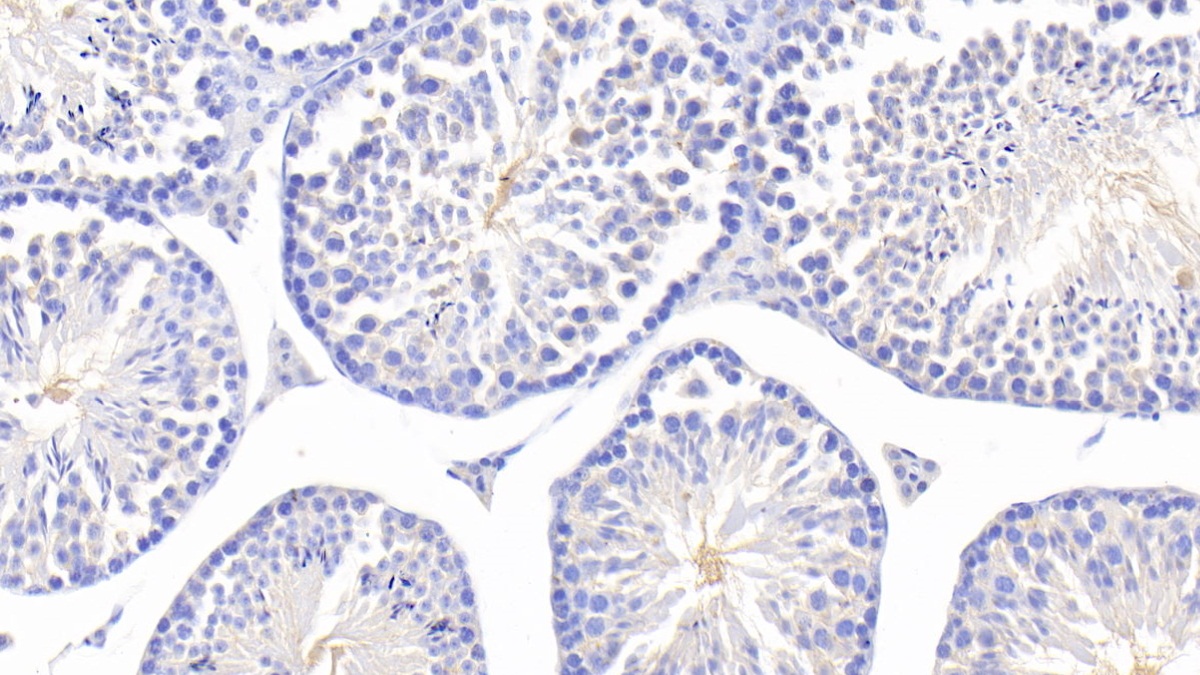 Polyclonal Antibody to Fucosidase Alpha L1, Tissue (FUCa1)