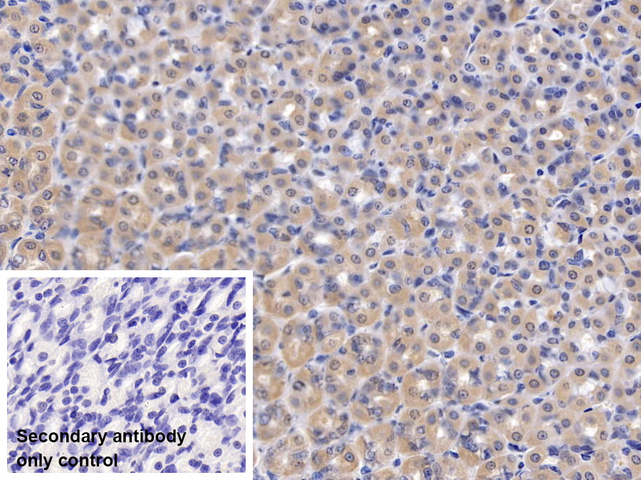 Polyclonal Antibody to Fucosidase Alpha L1, Tissue (FUCa1)