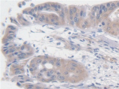 Polyclonal Antibody to Angiotensin I (AngI)