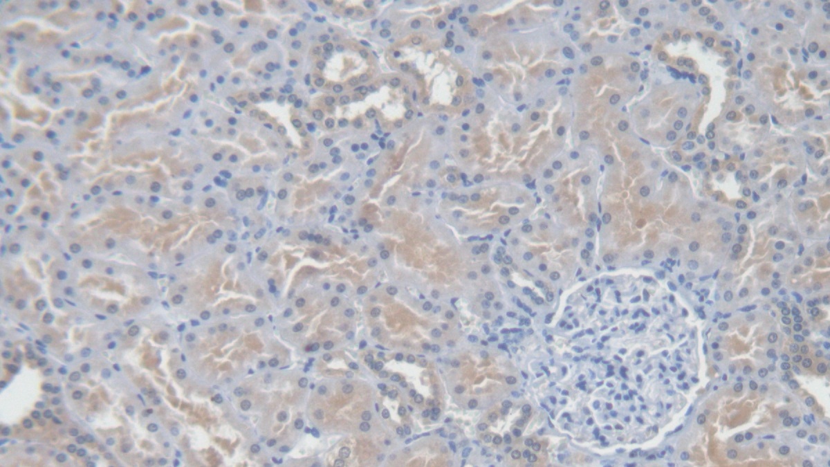 Polyclonal Antibody to Angiotensin I (AngI)