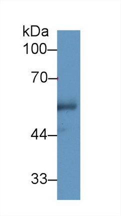 Polyclonal Antibody to Cholesteryl Ester Transfer Protein (CETP)