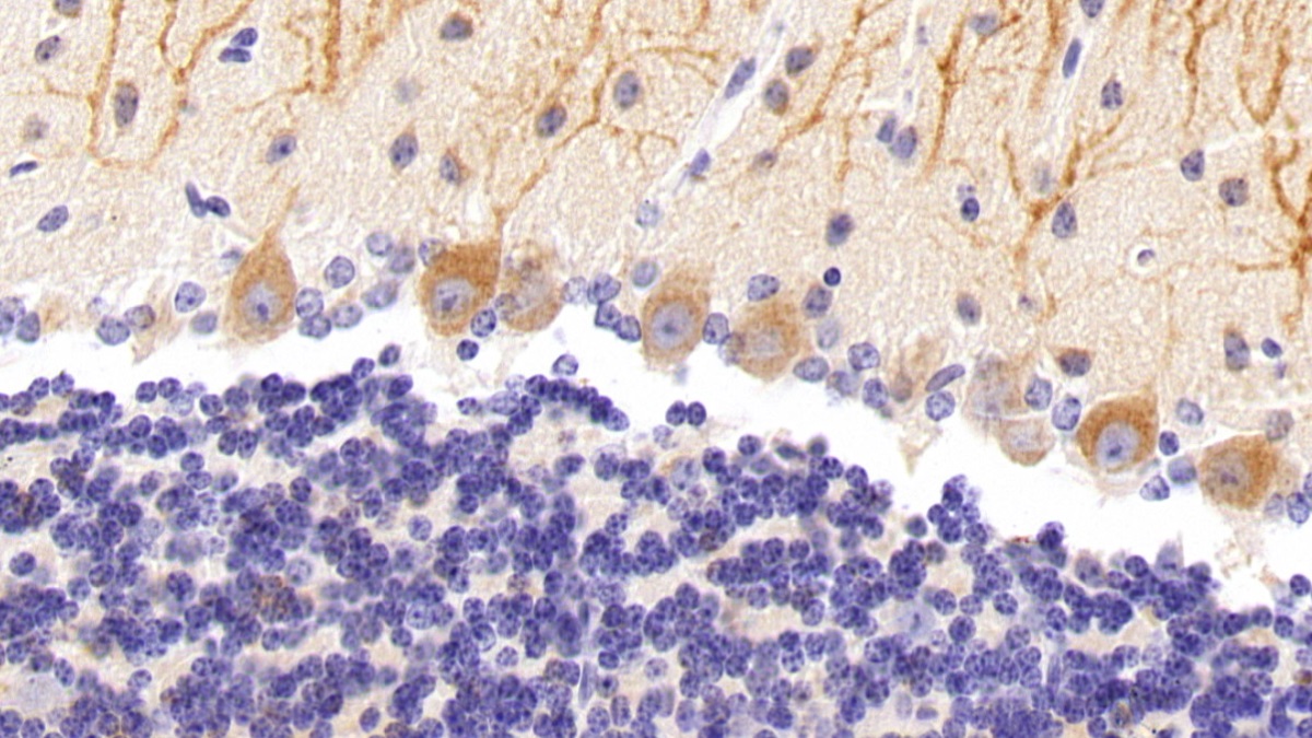 Polyclonal Antibody to Nitric Oxide Synthase 1, Neuronal (NOS1)