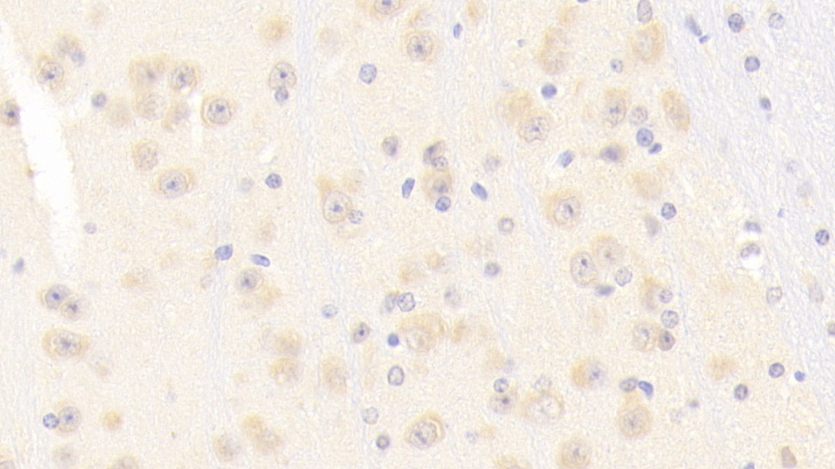 Polyclonal Antibody to Nitric Oxide Synthase 1, Neuronal (NOS1)