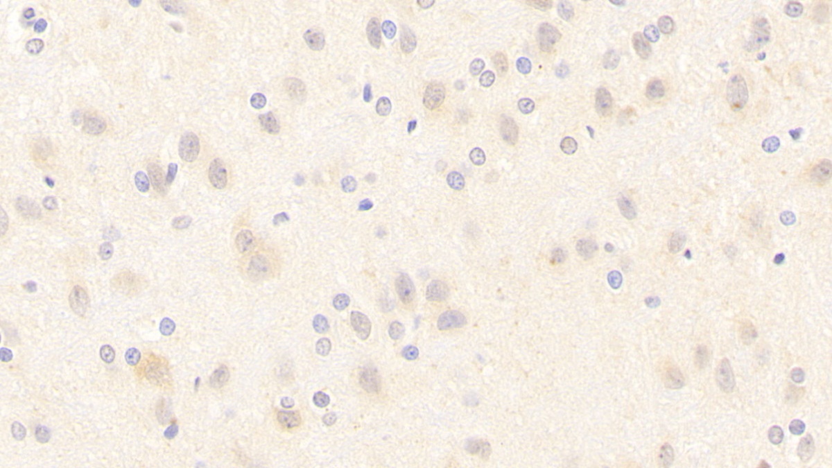 Polyclonal Antibody to Nitric Oxide Synthase 1, Neuronal (NOS1)