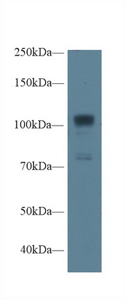 Polyclonal Antibody to Nitric Oxide Synthase 1, Neuronal (NOS1)