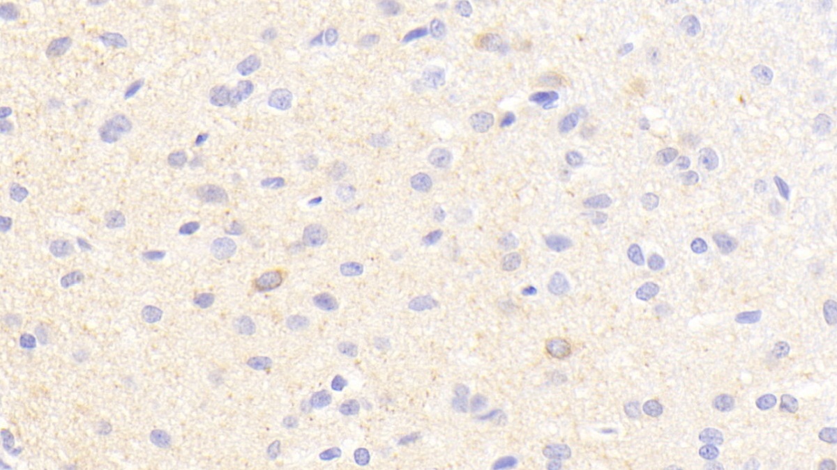 Polyclonal Antibody to Nitric Oxide Synthase 1, Neuronal (NOS1)