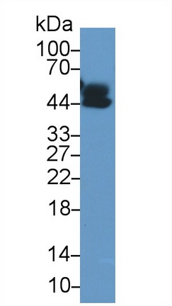 Polyclonal Antibody to Alpha-1-Acid Glycoprotein (a1AGP)