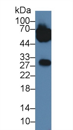 Polyclonal Antibody to Alpha-1-Acid Glycoprotein (a1AGP)