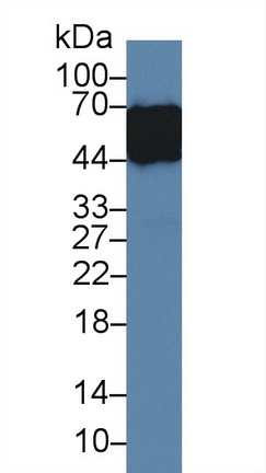 Polyclonal Antibody to Alpha-1-Acid Glycoprotein (a1AGP)