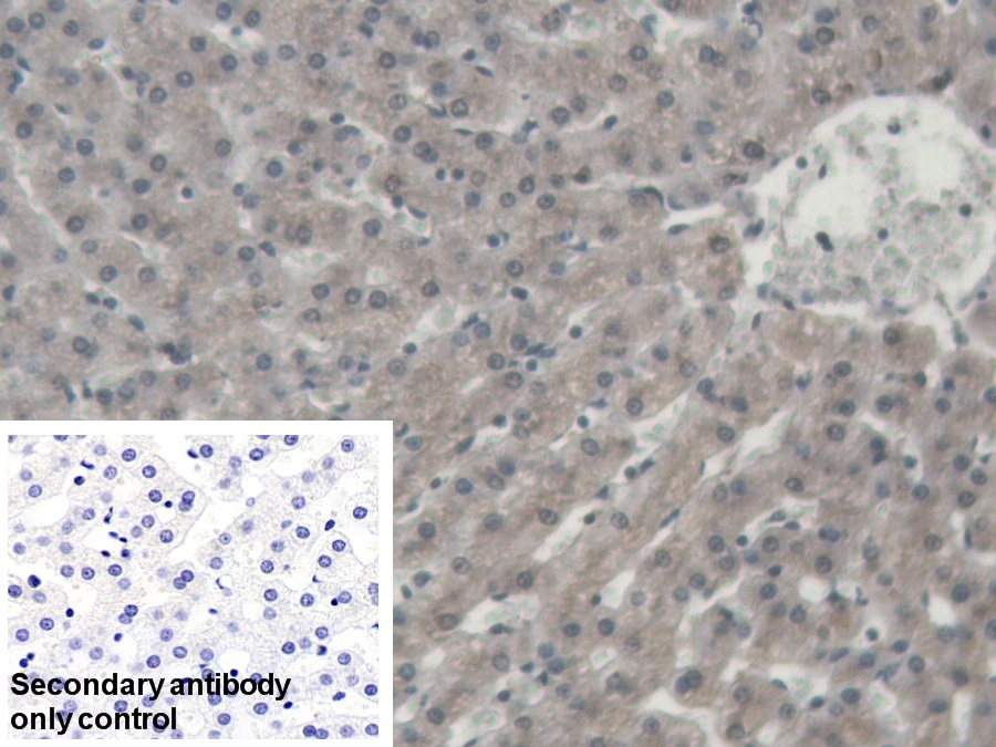 Polyclonal Antibody to Alpha-1-Acid Glycoprotein (a1AGP)