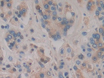 Polyclonal Antibody to Haptoglobin (Hpt)