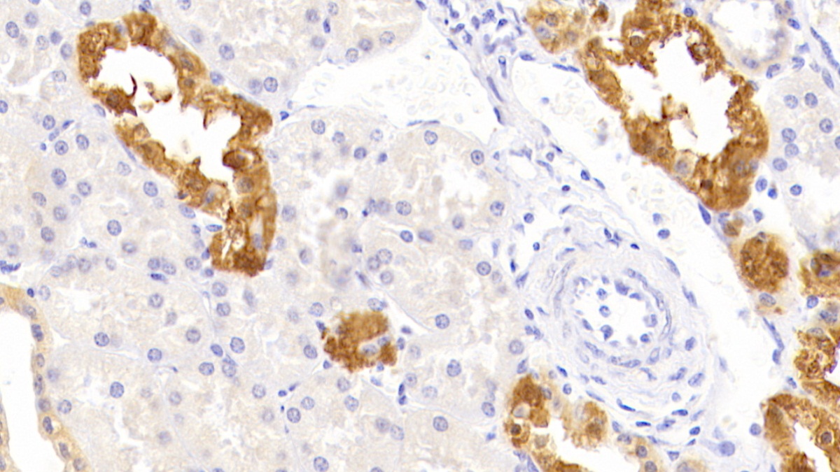 Polyclonal Antibody to Death receptor 5 (DR5)