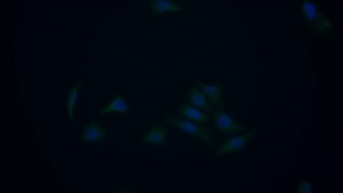 Polyclonal Antibody to Death receptor 5 (DR5)