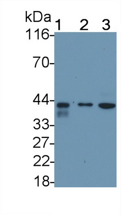 Polyclonal Antibody to Death receptor 5 (DR5)