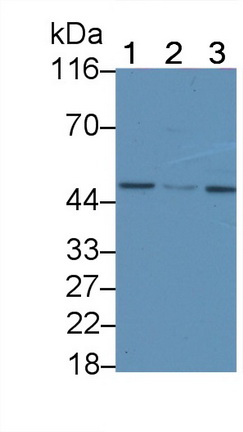 Polyclonal Antibody to Death receptor 5 (DR5)