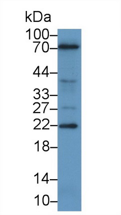 Polyclonal Antibody to Parathyroid Hormone Related Protein (PTHrP)