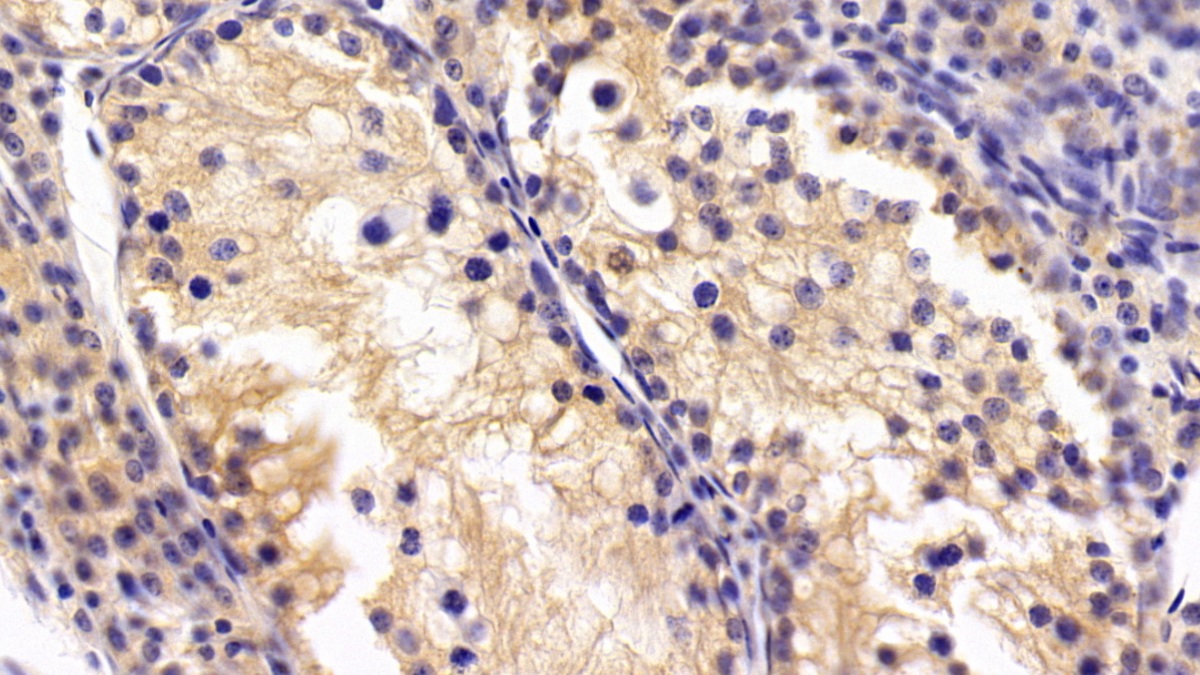 Polyclonal Antibody to Parathyroid Hormone Related Protein (PTHrP)