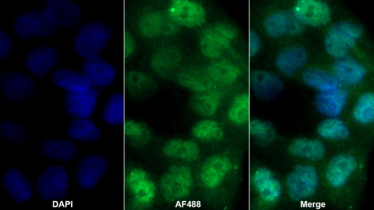 Polyclonal Antibody to Parathyroid Hormone Related Protein (PTHrP)