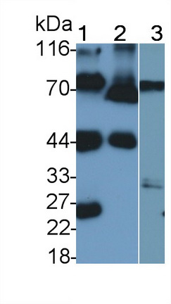 Polyclonal Antibody to Coagulation Factor II (F2)