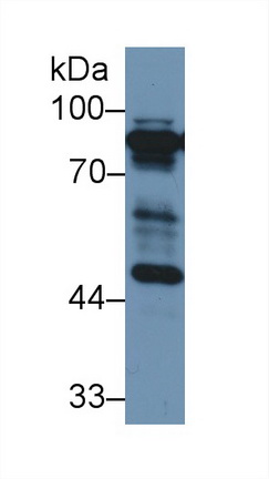 Polyclonal Antibody to Coagulation Factor II (F2)