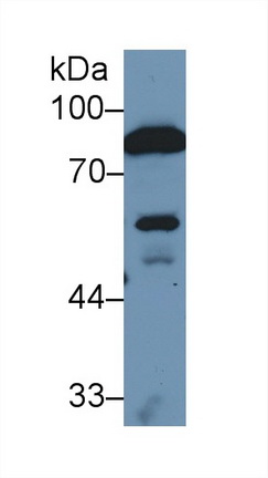 Polyclonal Antibody to Coagulation Factor II (F2)