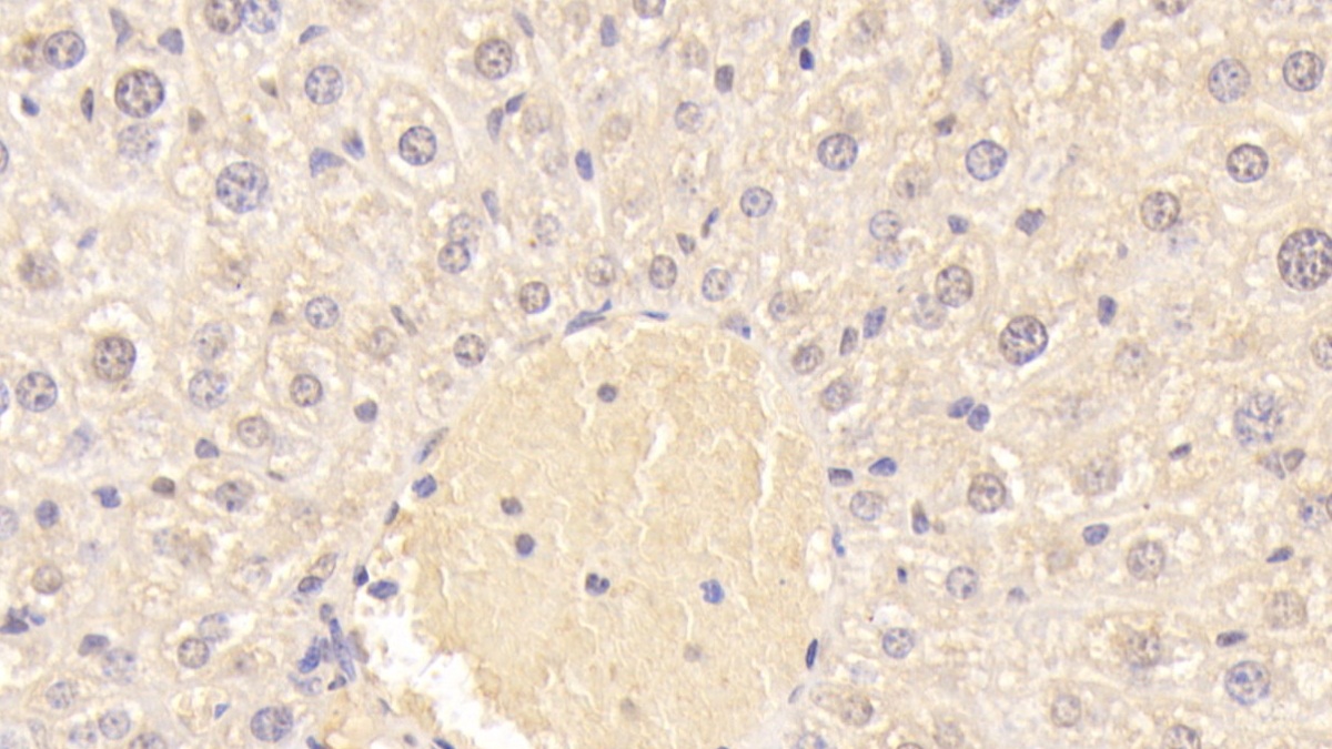 Polyclonal Antibody to Coagulation Factor II (F2)