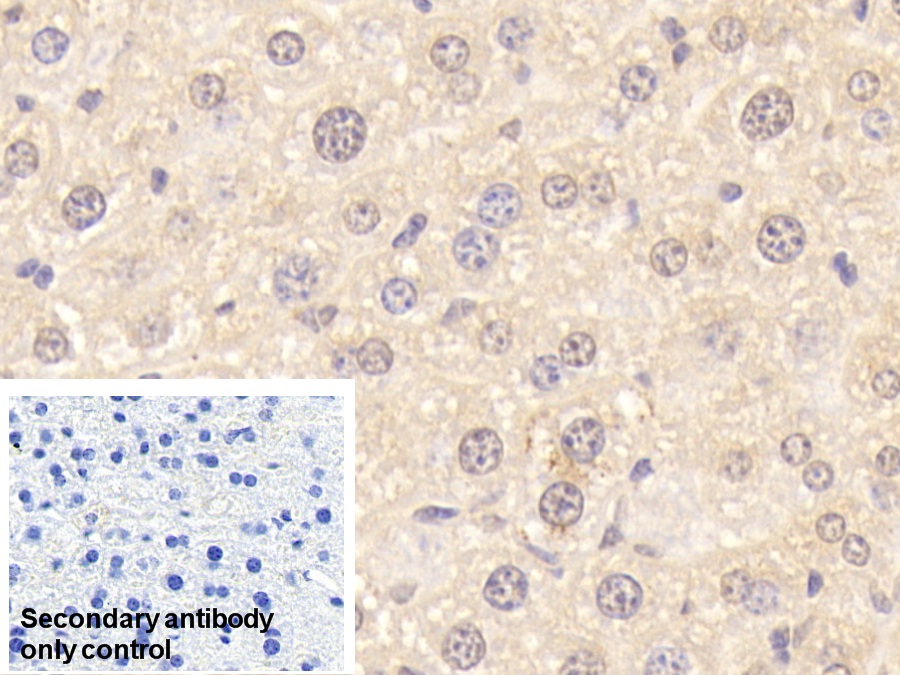 Polyclonal Antibody to Coagulation Factor II (F2)