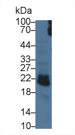 Polyclonal Antibody to C Reactive Protein (CRP)