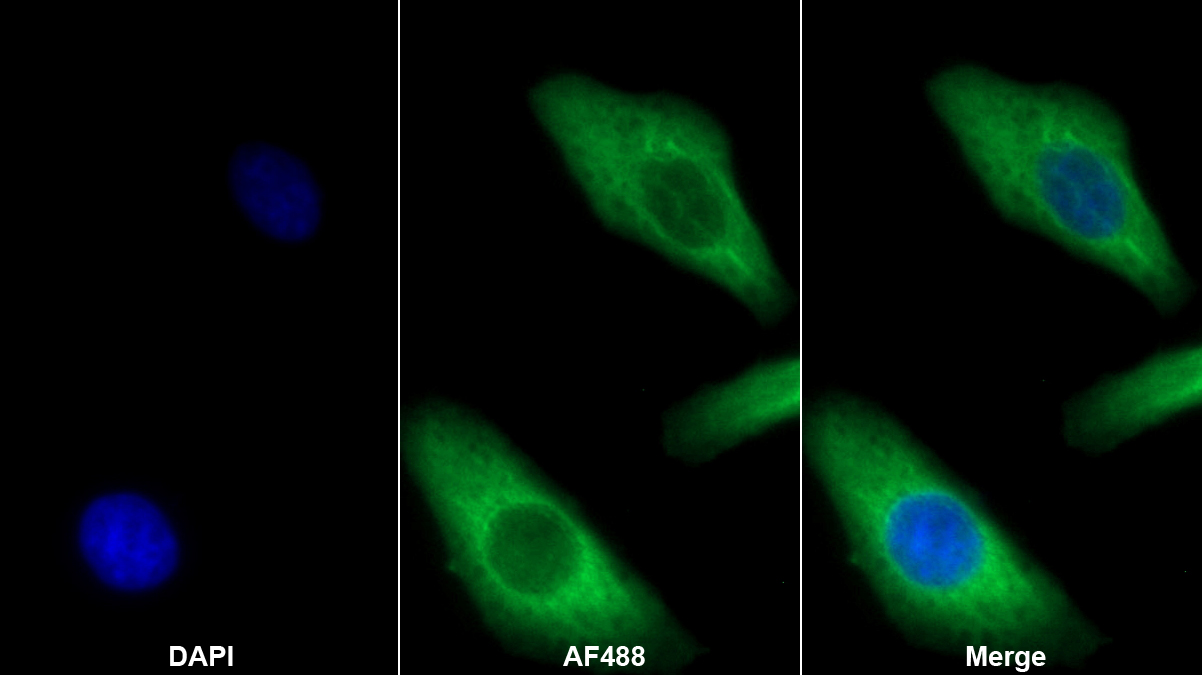 Polyclonal Antibody to C Reactive Protein (CRP)